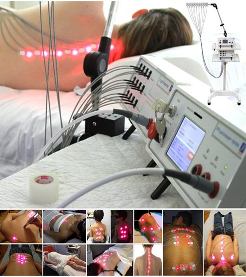Laser acupuncture laser therapy